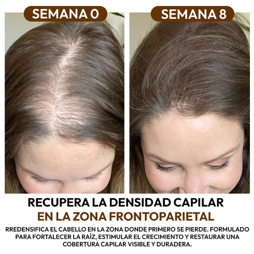 Aceite de Batana 100% Natural: Fortalece la Raíz y Acelera el Crecimiento Capilar