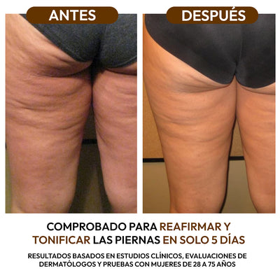 Aceite Reductor Anticelulitis con Colágeno y Células Madre