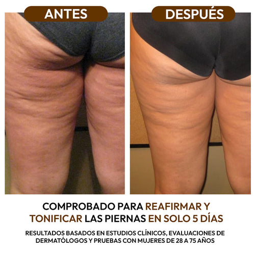 Aceite Reductor Anticelulitis con Colágeno y Células Madre