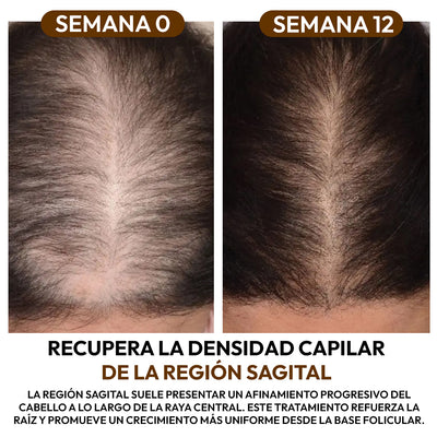 Aceite de Batana 100% Natural: Fortalece la Raíz y Acelera el Crecimiento Capilar