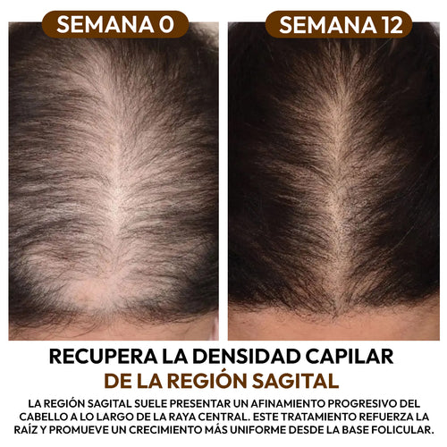 Aceite de Batana 100% Natural: Fortalece la Raíz y Acelera el Crecimiento Capilar
