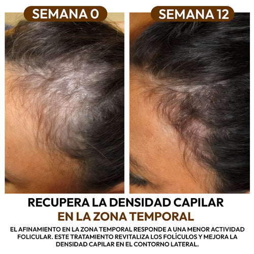 Aceite de Batana 100% Natural: Fortalece la Raíz y Acelera el Crecimiento Capilar