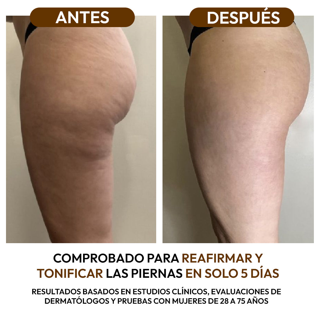 Aceite Reductor Anticelulitis con Colágeno y Células Madre