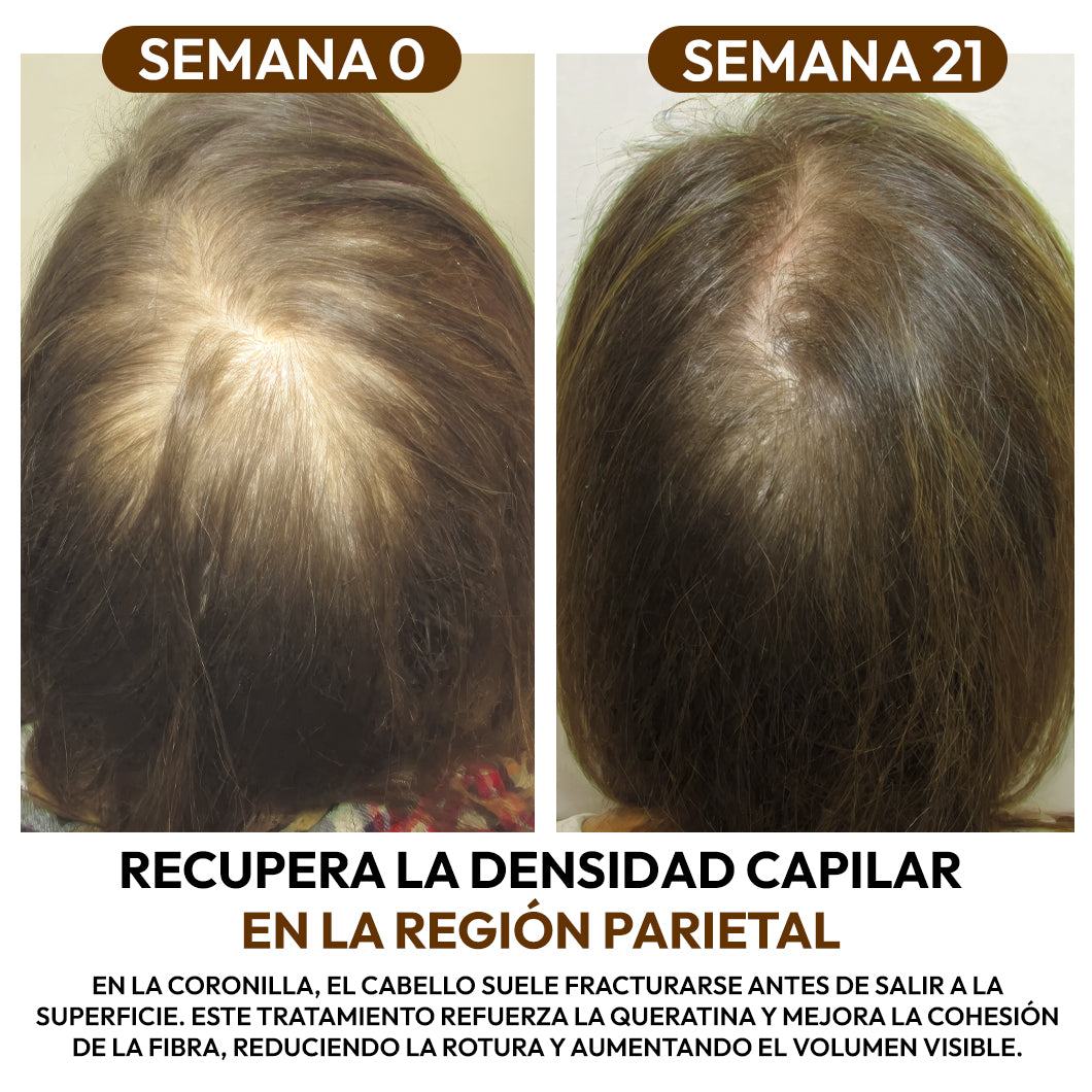 Aceite de Batana 100% Natural: Fortalece la Raíz y Acelera el Crecimiento Capilar