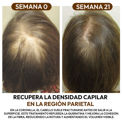 Aceite de Batana 100% Natural: Fortalece la Raíz y Acelera el Crecimiento Capilar
