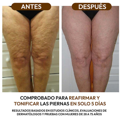 Aceite Reductor Anticelulitis con Colágeno y Células Madre