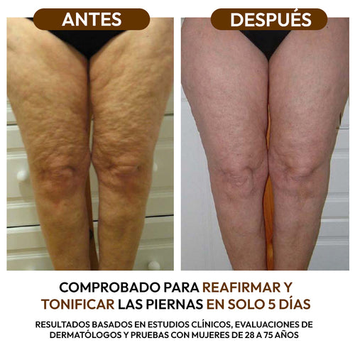 Aceite Reductor Anticelulitis con Colágeno y Células Madre
